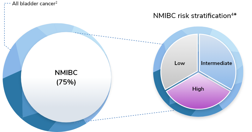 Chart showing 75% non-muscle-invasive bladder cancer prevalence in the US