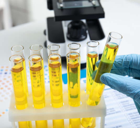 Image of a uro-uncologist’s gloved hands scanning a urinary biomarker test to help detect non-muscle-invasive bladder cancer